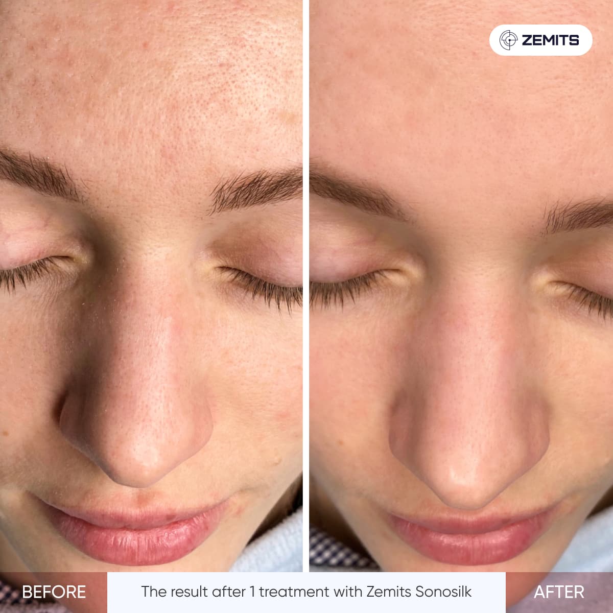 Before After Slide 1