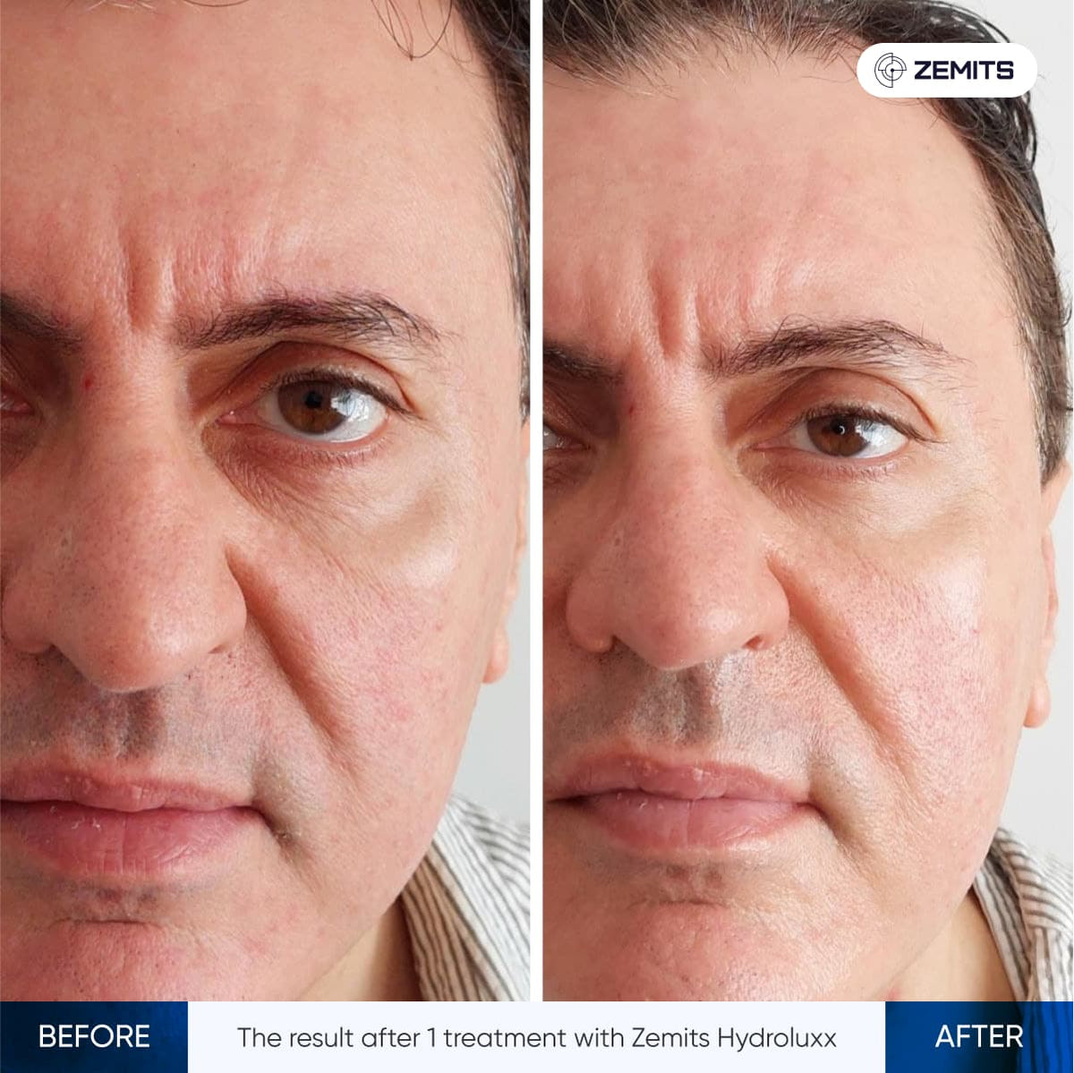 Before After Slide 4
