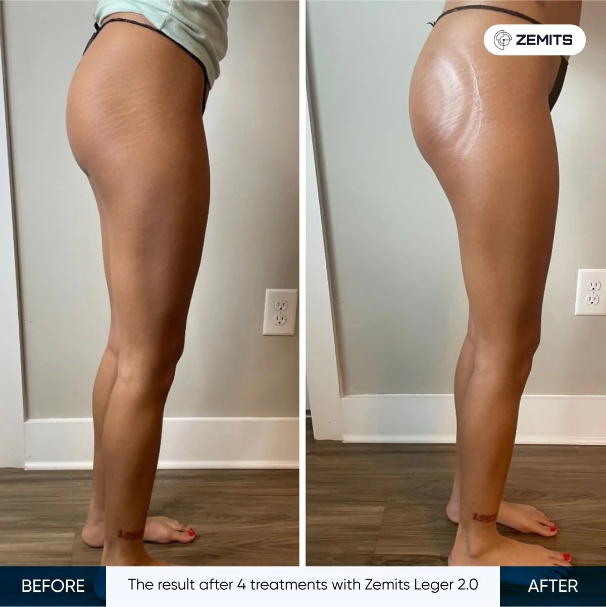 Before After Slide 1