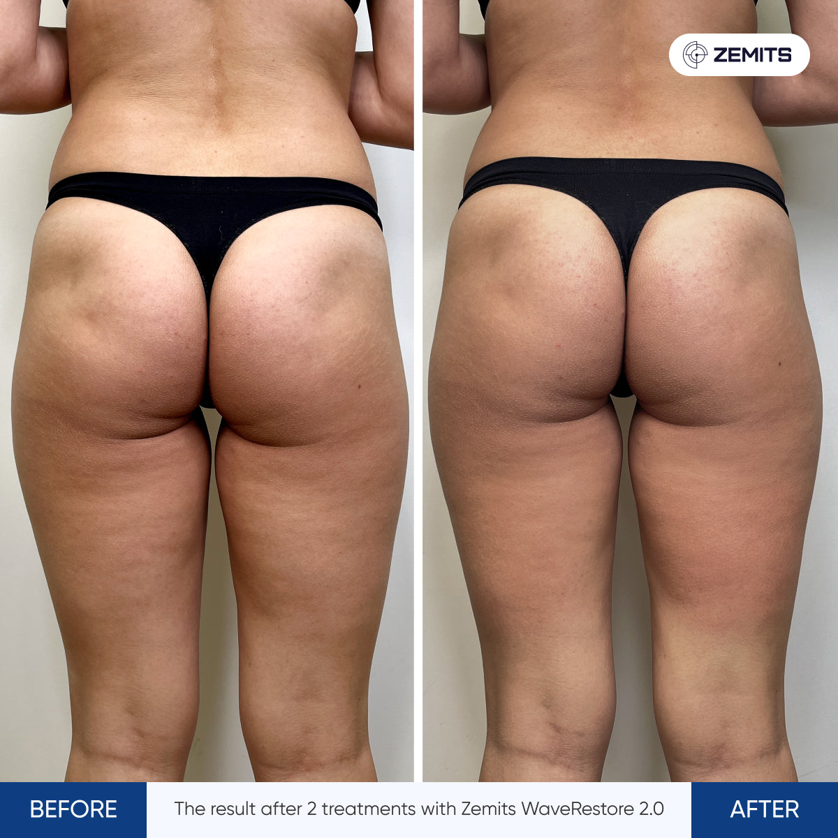 Before After Slide 1
