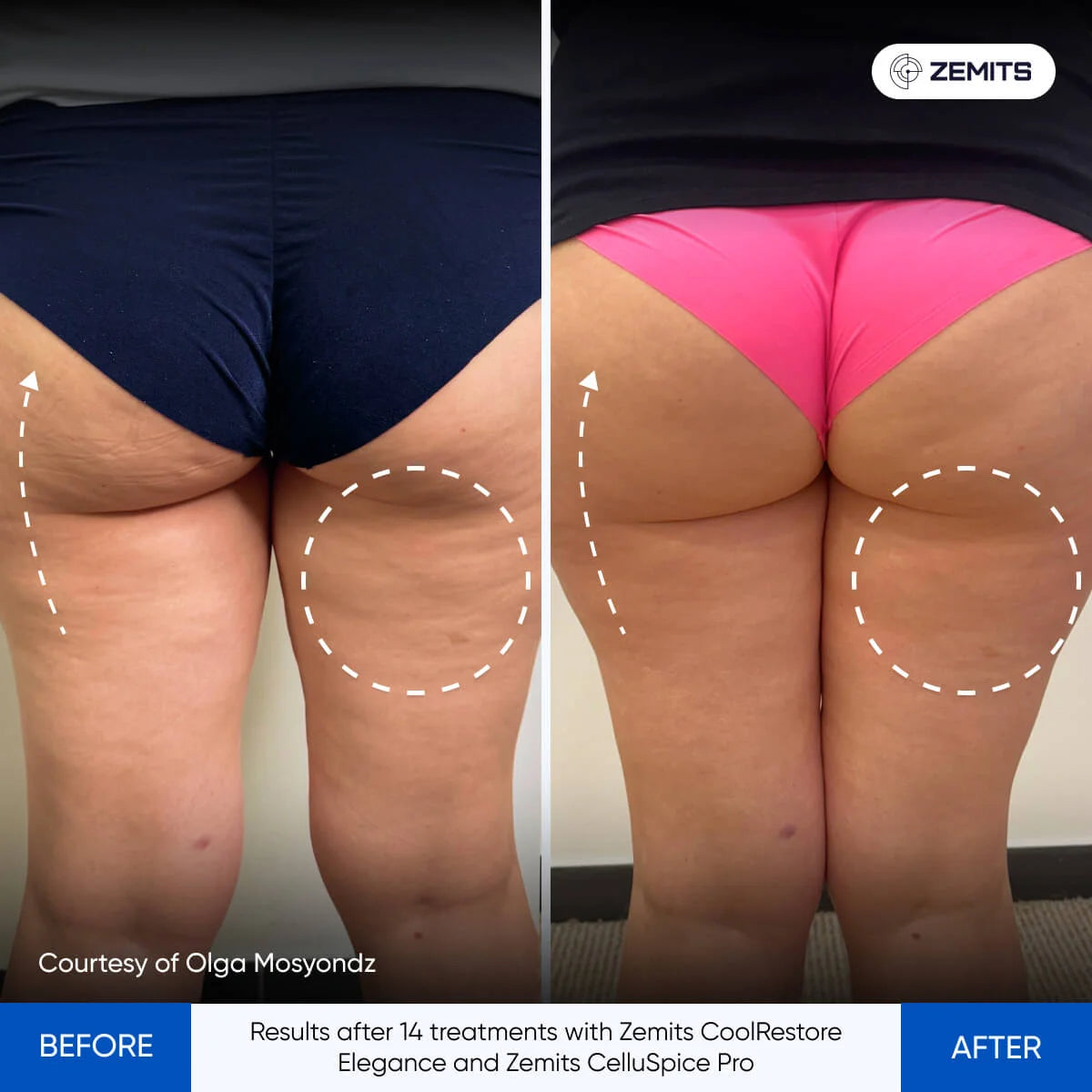 Before After Slide 3