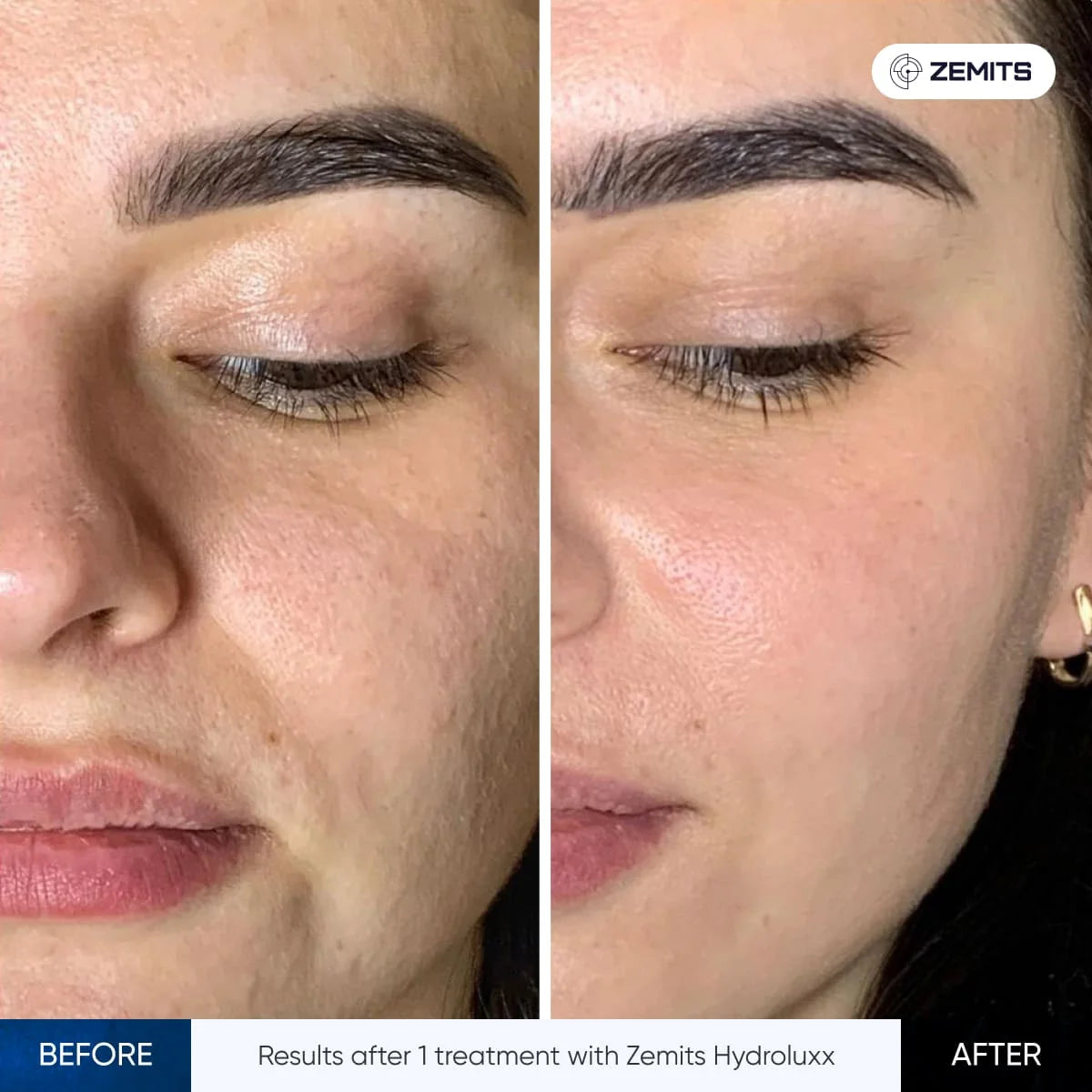 Before After Slide 5