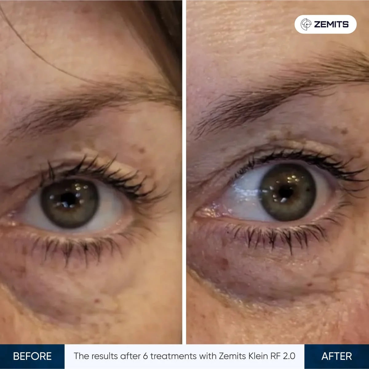 Before After Slide 19