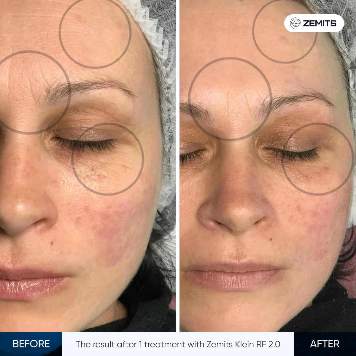 Before After Slide 20