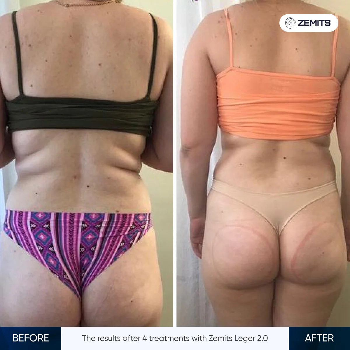 Before After Slide 2