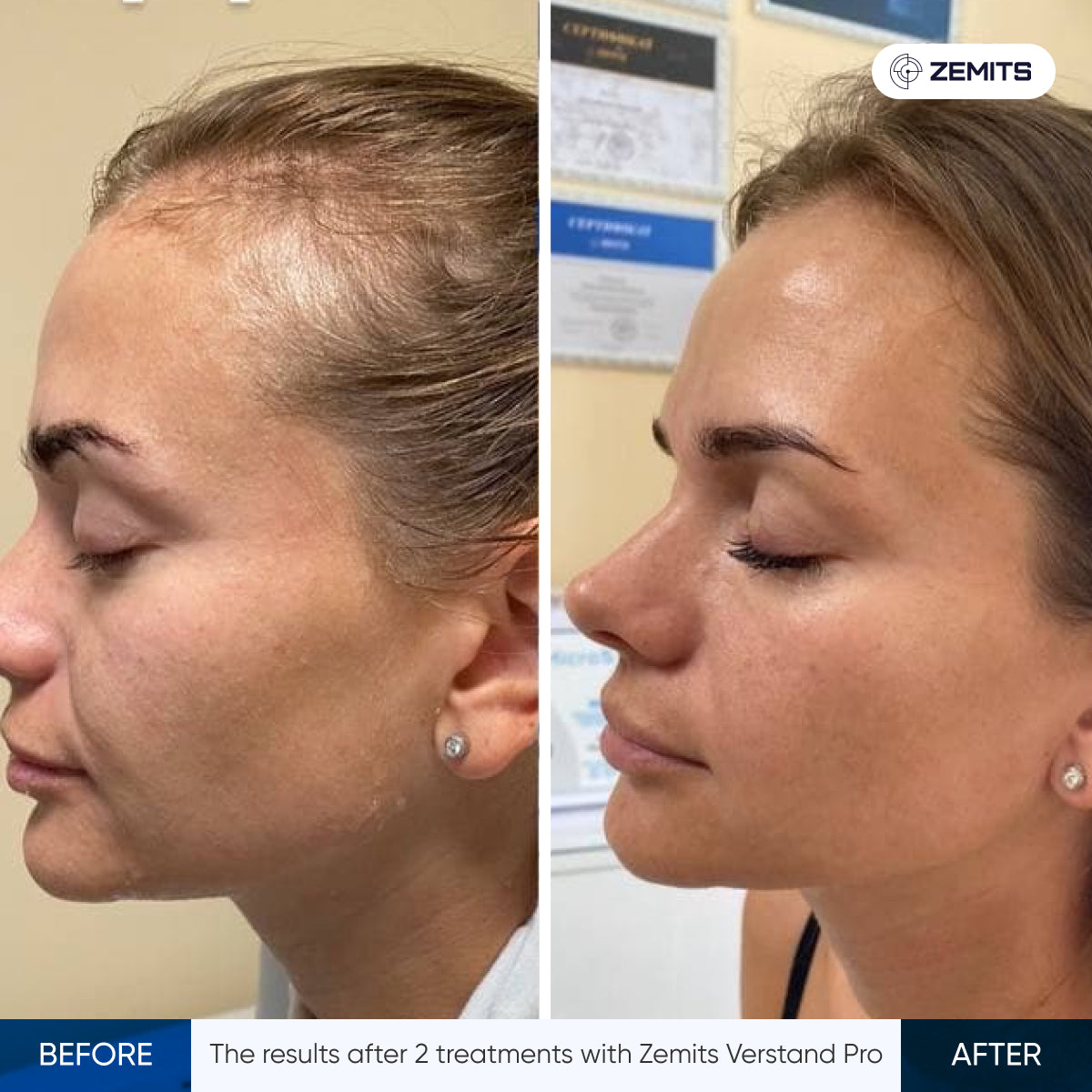 Before After Slide 1