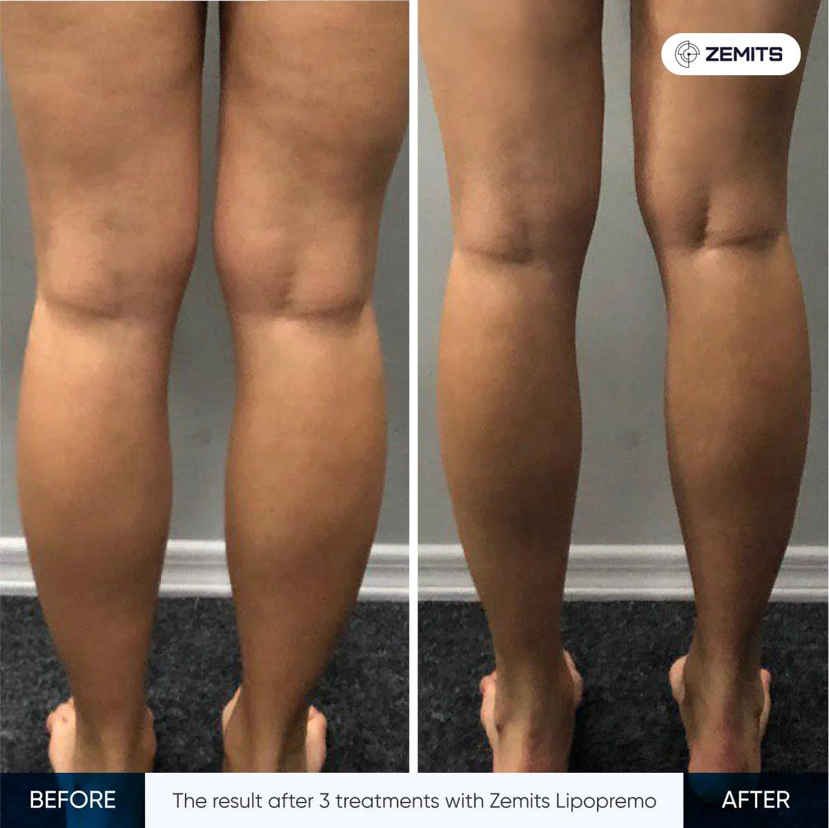 Before After Slide 1