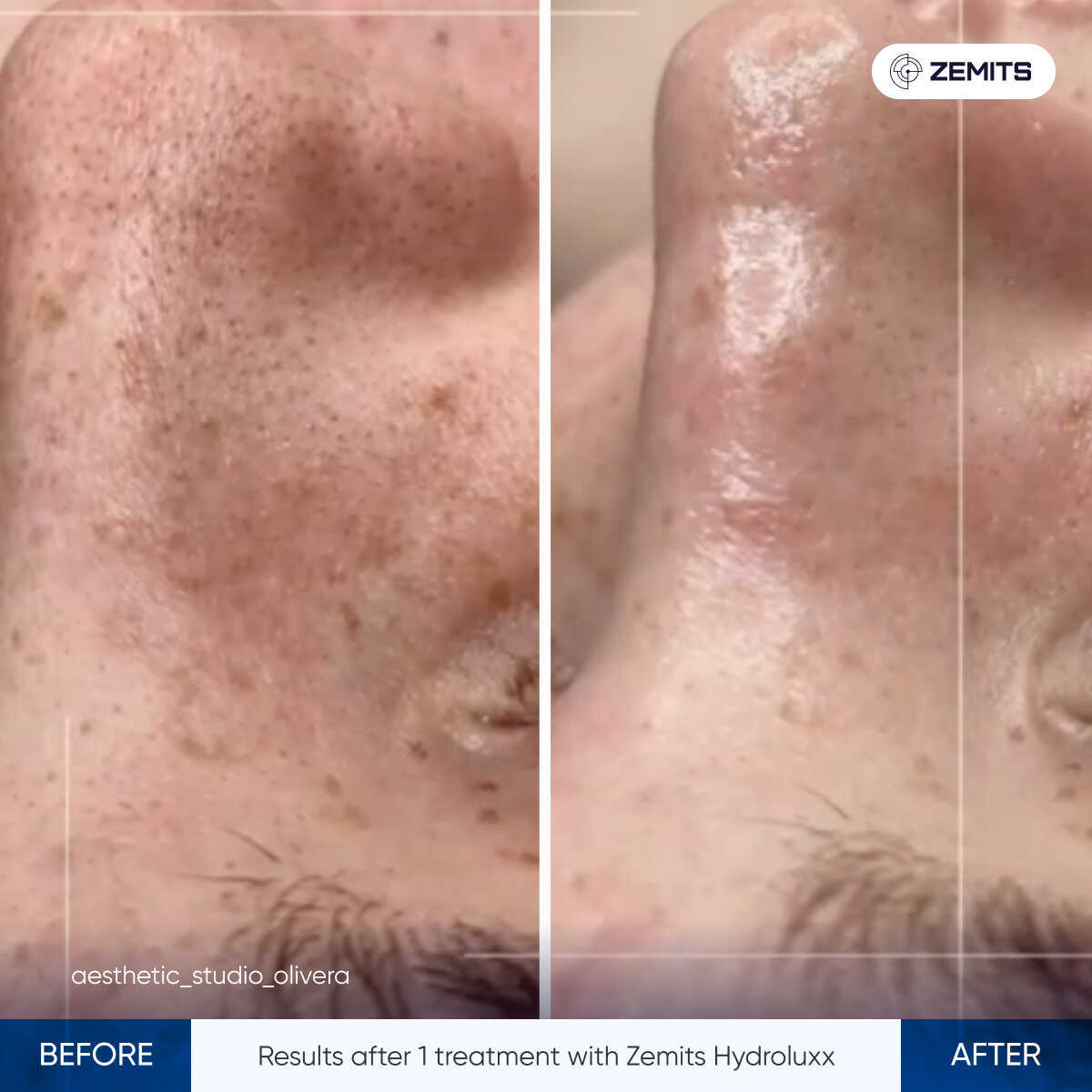Before After Slide 3