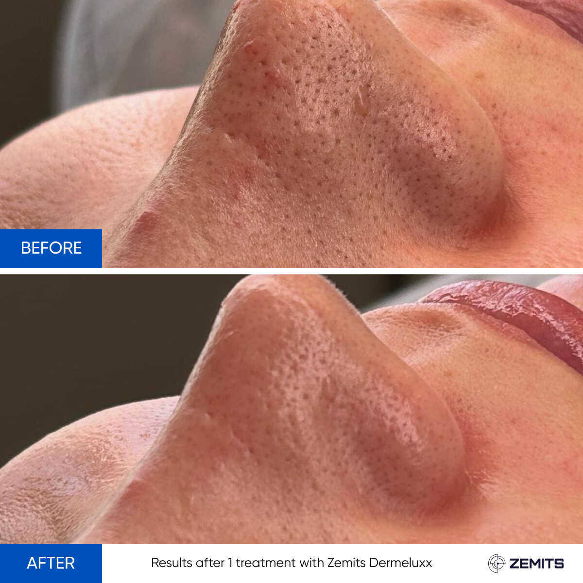 Before After Slide 1