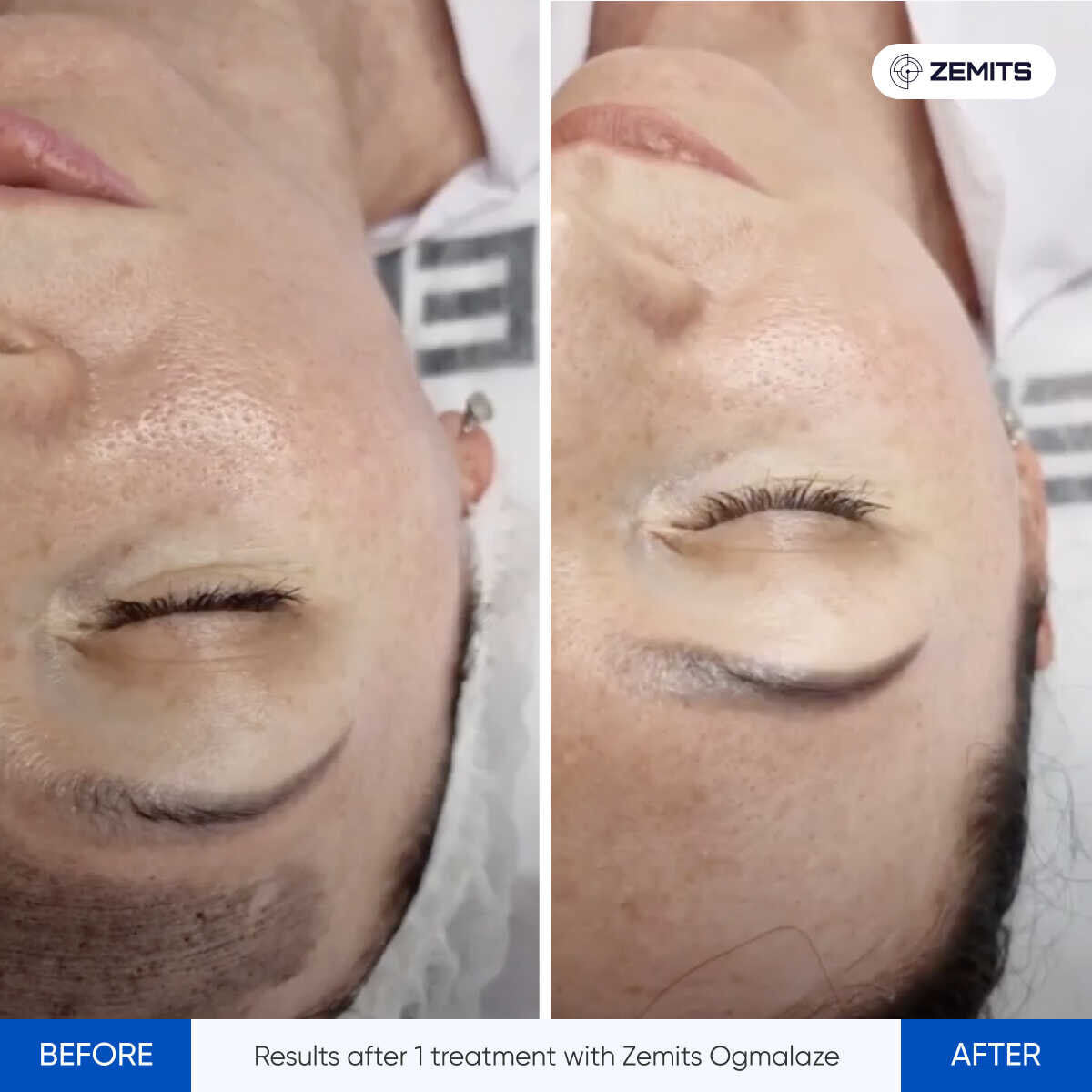 Before After Slide 3