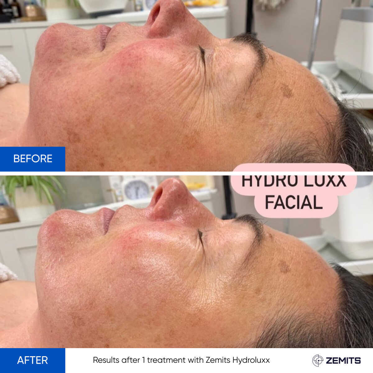 Before After Slide 6