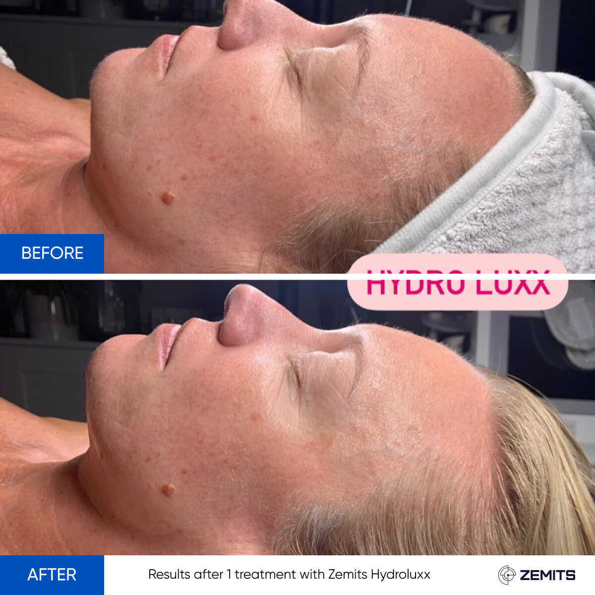 Before After Slide 2