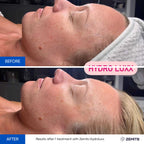 Zemits HydroLuxx