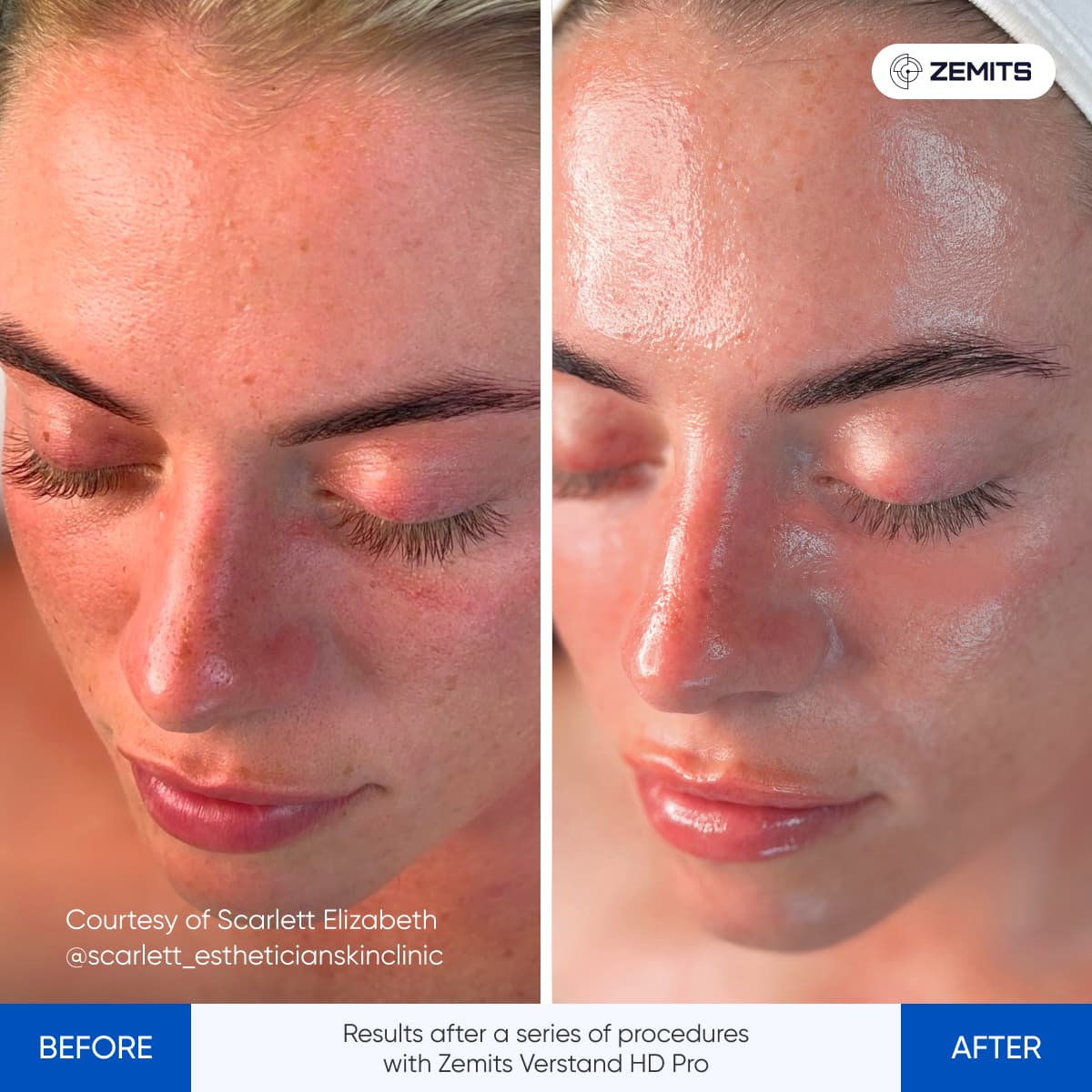 Before After Slide 5