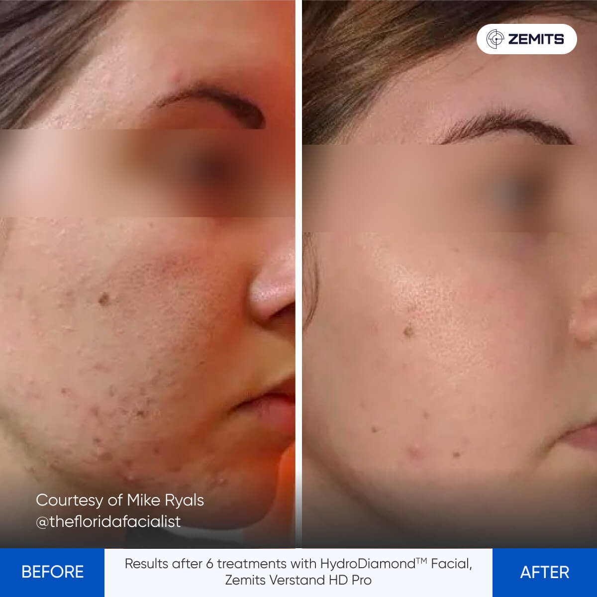 Before After Slide 2