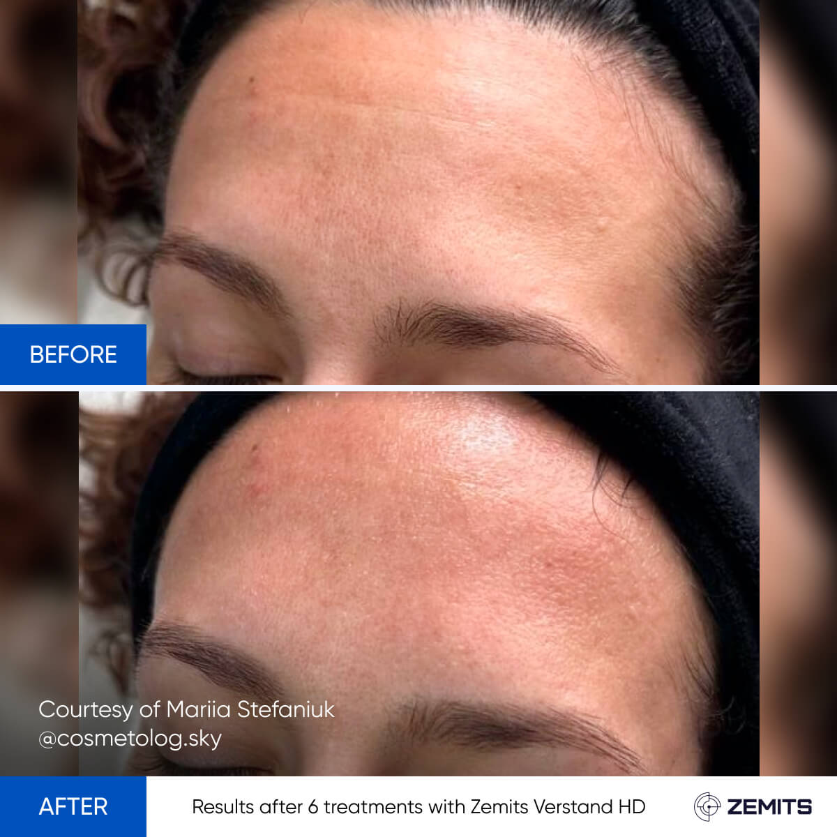 Before After Slide 7