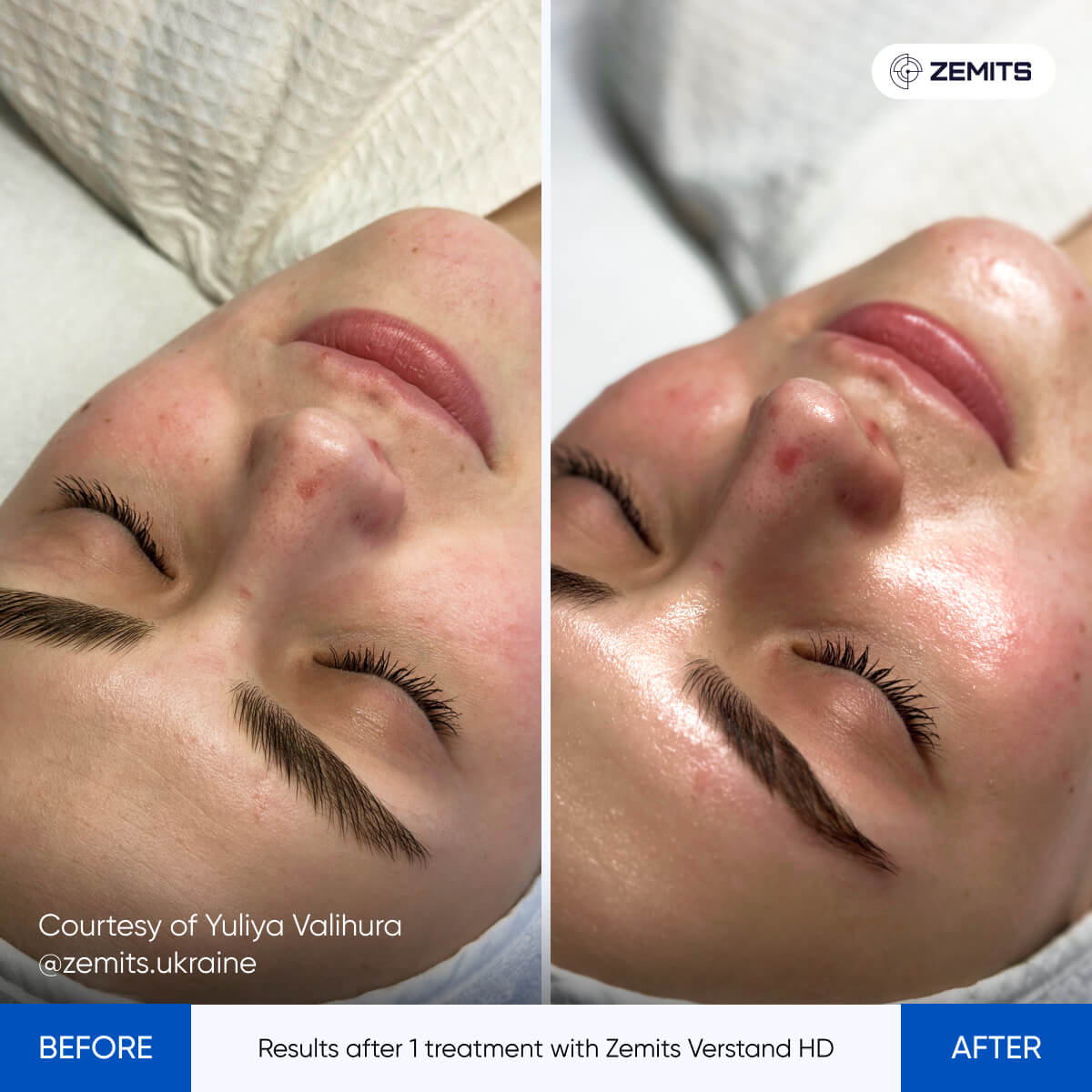 Before After Slide 3