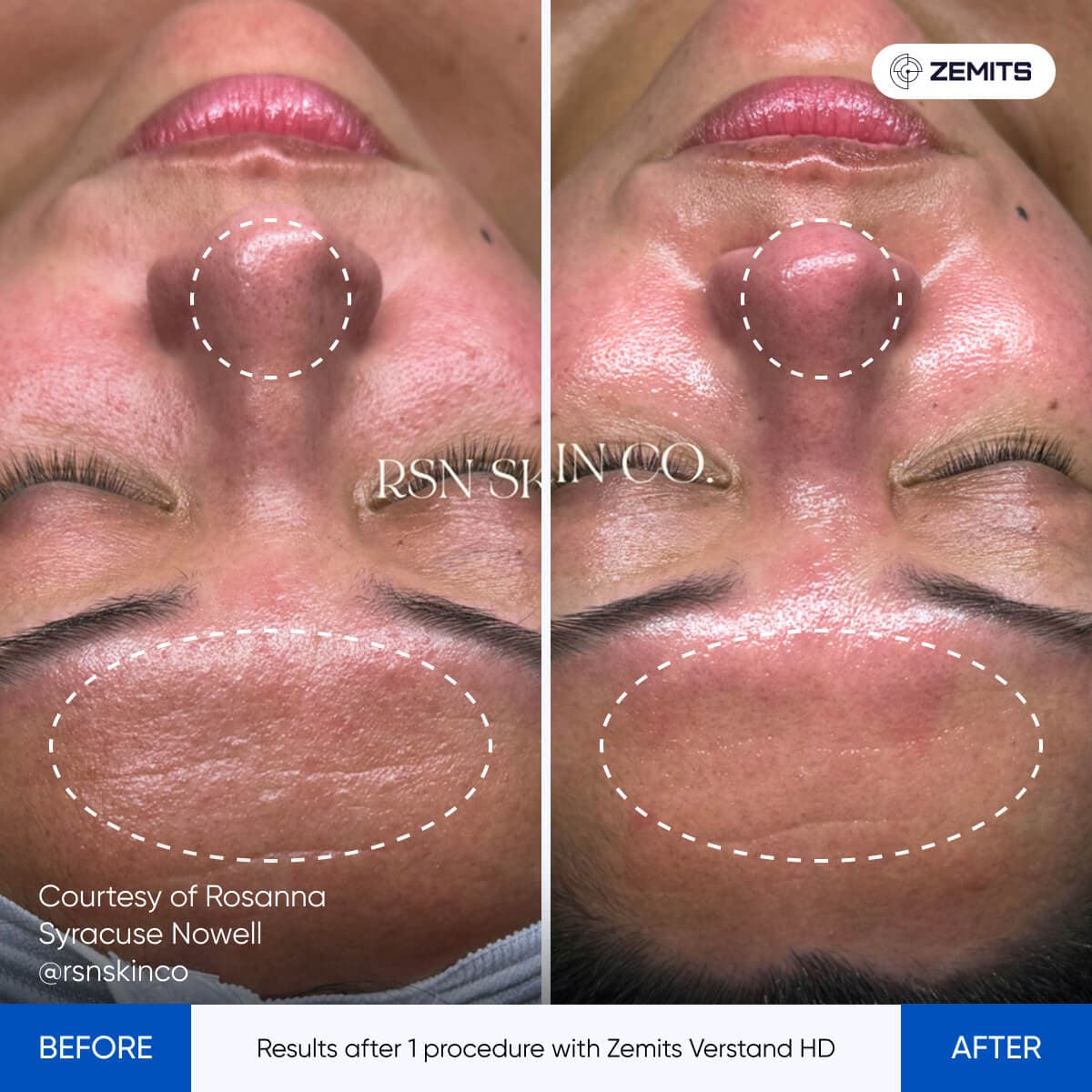 Before After Slide 9