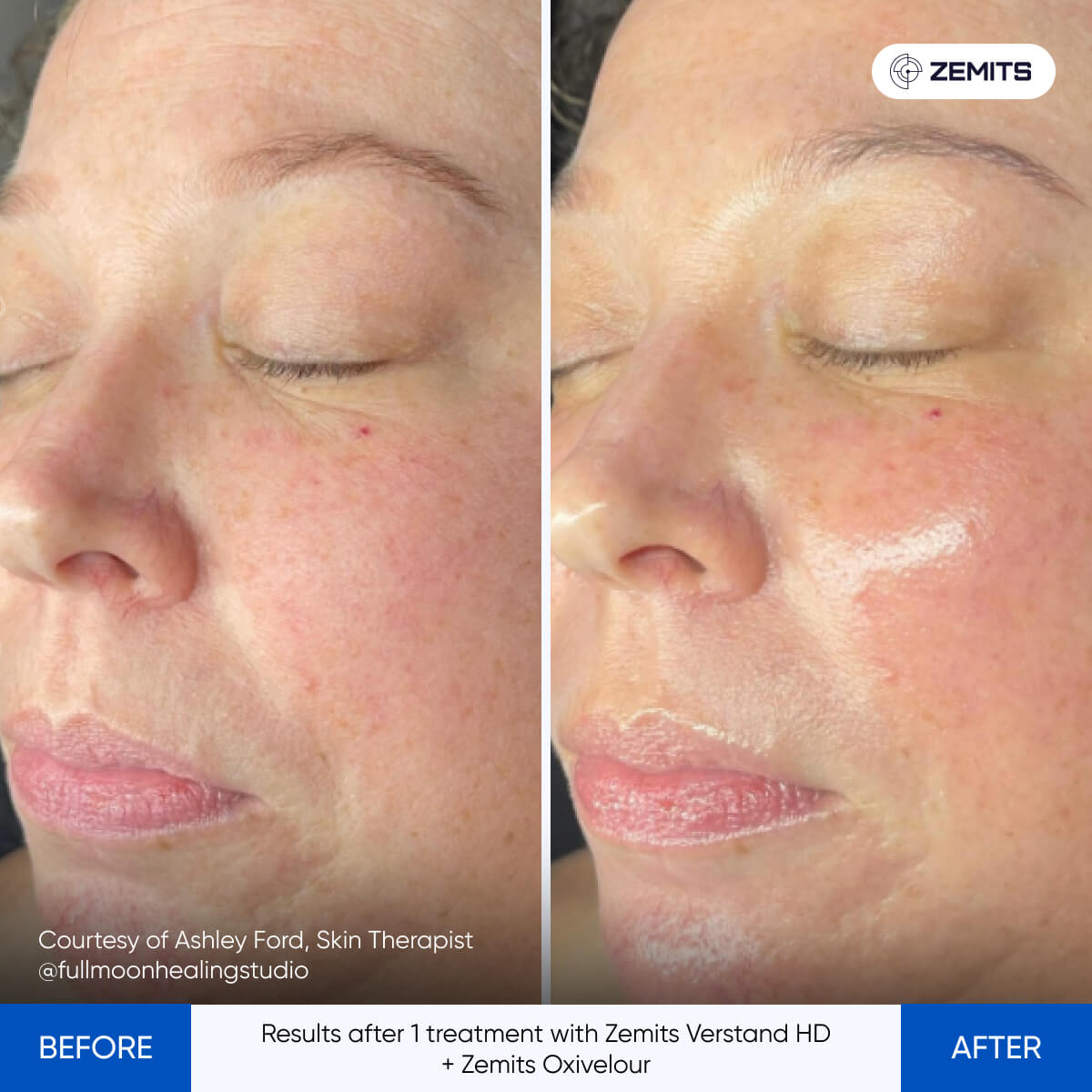 Before After Slide 4
